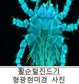 가을의 숨은 위협, 털진드기 활동 급증 야외활동 시 주의 필요 기사 이미지