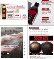 탈모치료 효과 표방한 의료기기, 화장품 등 온라인 부당광고 376건 적발 기사 이미지